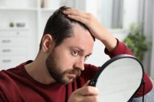 Sons – Possible Treatment Plans for Hair Loss