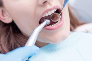 The hidden costs of poor dental service and how to recover them legally